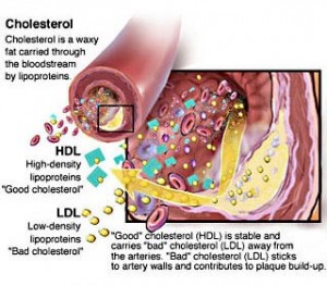 cholesterol1